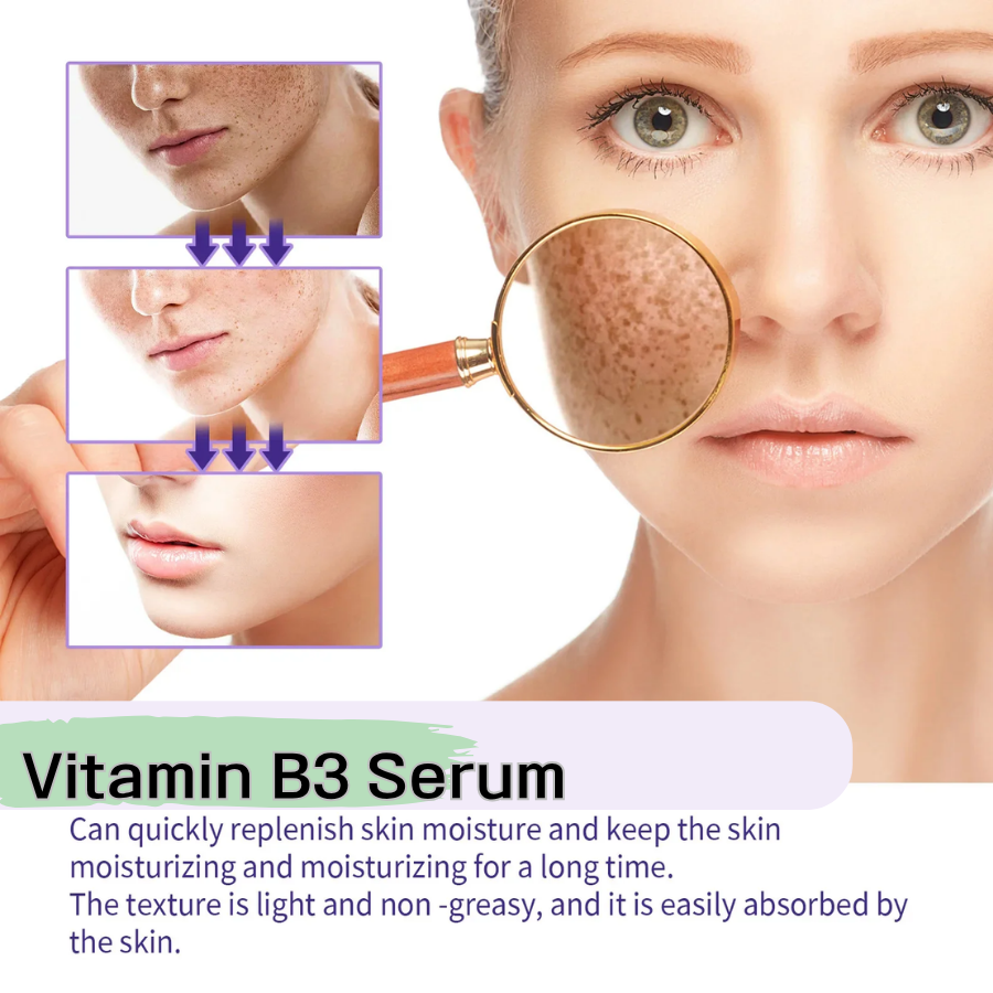 Shopify Product Description – Vitamin B3 Brightening & Dark Spot Correcting Serum