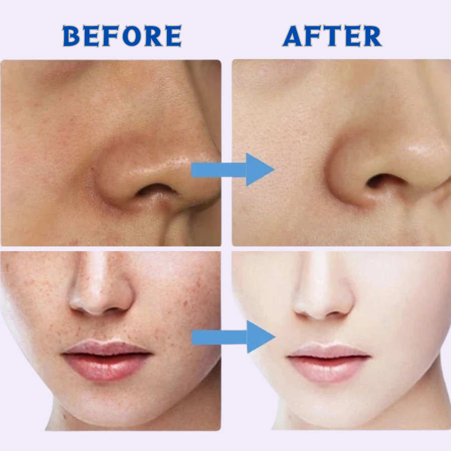 Shopify Product Description – Vitamin B3 Brightening & Dark Spot Correcting Serum